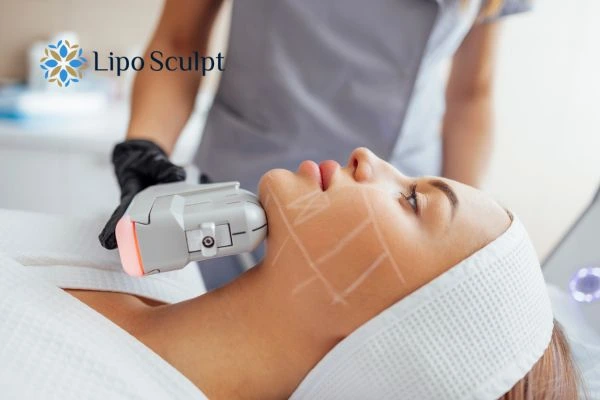 HIFU vs Botulinum Toxin: Understanding the Differences 1 HIFU vs Botox Newham What is the best option for you?