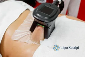 Cryolipolysis Helping You Getting that Perfect Summer Body 3 Cryolipolysis Newham can give you the best summer body - contact us today!