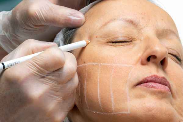 CryoPen: 5 Skin Concerns It May Be Used to Treat 4 What should you ask before having CryoPen treatment Newham?