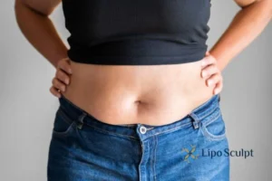 Bidding Farewell to Muffin Tops with Aqualyx Fat Injections 2 Do you wish you could reduce your muffin top Newham With Aqualy fat dissolving injections you can!